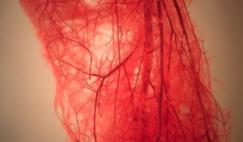 Casa di Cura BarbantiniL’insufficienza venosa e le sue complicanze